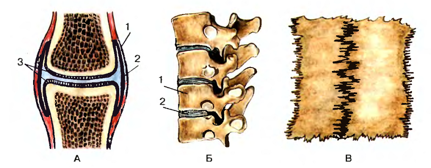 Типы соединения костей: А- сустав (1 - связки; 2 - суставная сумка (выделена черным); 3 - суставный хрящ); Б - полуподвижные соединения (1 - тела позвонков; 2 - межпозвоночные диски); В - неподвижные соединения - швы. Автор24 — интернет-биржа студенческих работ